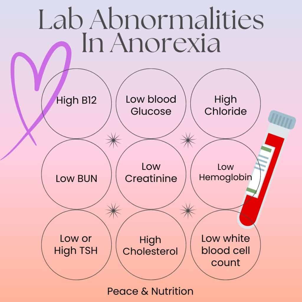 infographic of lab abnormalities in anorexia