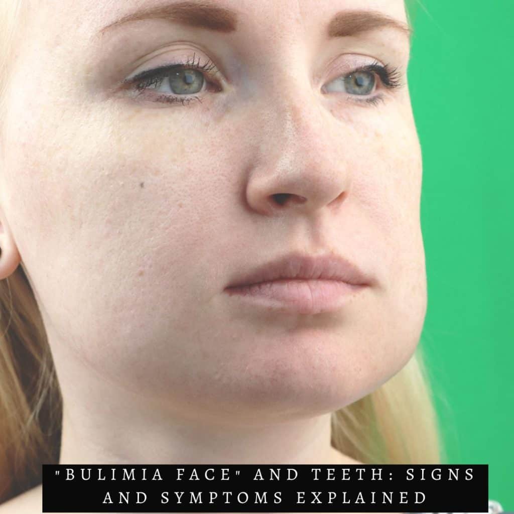 info graphic of woman with puffy cheeks
